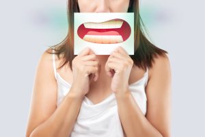 the link between mouth breathing and dental problems