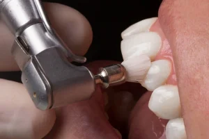 how much does a dental cleaning cost