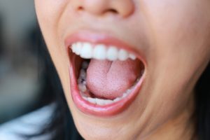 what are the signs you need a tooth filling