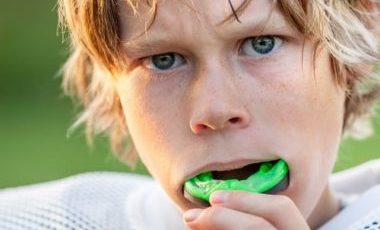 Mouthguards Prevent Dental Injuries Calgary Dentist Free Consultation