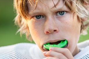 mouthguards prevent dental injuries
