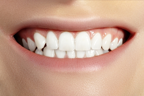 Teeth Bleaching in Calgary Tooth Whitening Inglewood Family Dental