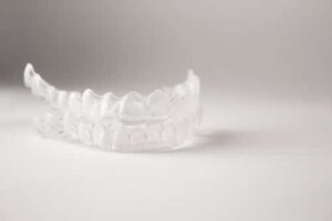 Teeth Grinding Guard in Calgary | Inglewood Family Dental | Bruxism