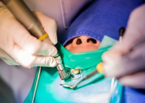 sedation dentist