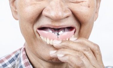 Calgary Dentures 101 What You Need To Know Inglewood Family Dental