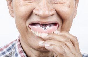 calgary dentures 101 what you need to know