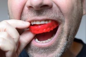 mouth guard dentist in calgary