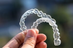 Invisible Aligners - Top Benefits | Invisalign in Calgary | Free Consultation