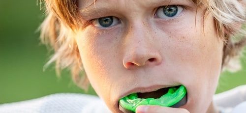Sports Mouth Guards FAQ's | Dental Mouthguards for Athletes in Calgary