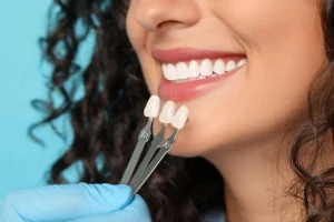 affordable dental veneers in calgary