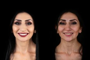 restorative dentist in calgary