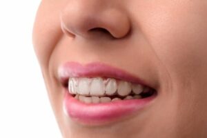 Cosmetic Dentist in Southeast Calgary | Calgary Dentist