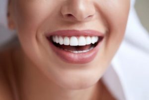inexpensive veneers
