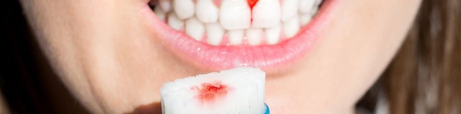 is gingivitis a contagious disease?