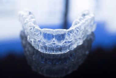 Invisalign Braces | Clear Aligners for Straight Teeth | Dentist in Calgary