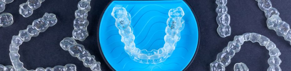 Affordable Braces in Calgary Invisalign Starting at only $150 Monthly