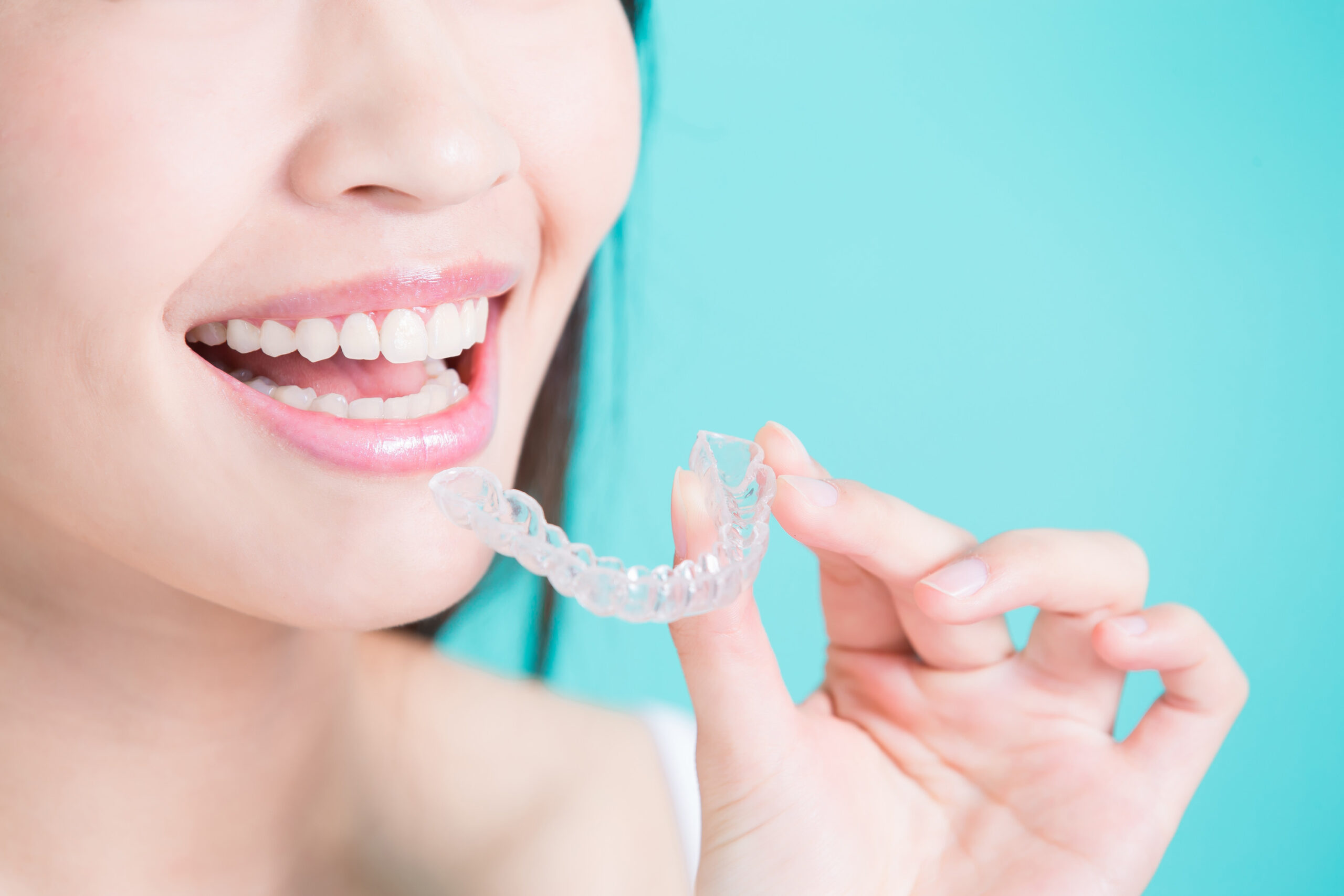 Is it Possible to get Invisalign Aligners for Bottom Teeth Only
