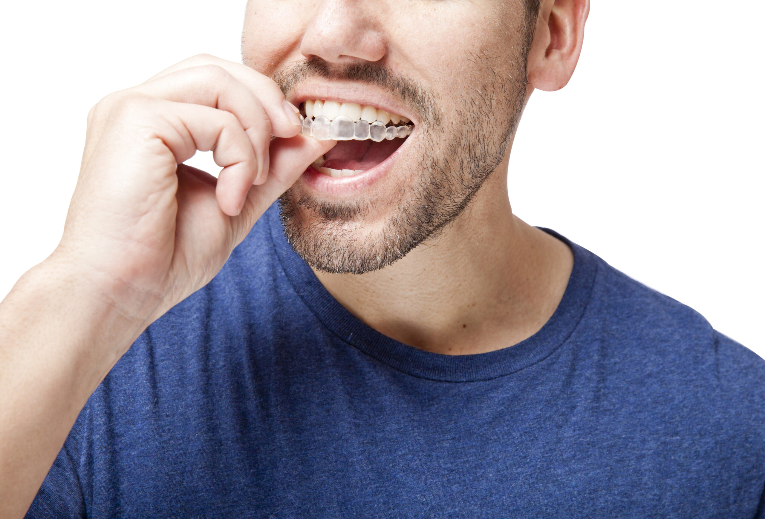 Tips to Reduce Discomfort with Invisalign
