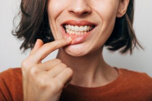 Link between diabetes and gum disease