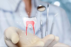 what are the 3 stages of root canal treatment
