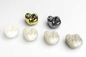 https://www.inglewoodfamilydental.ca/dental-crowns-in-calgary/