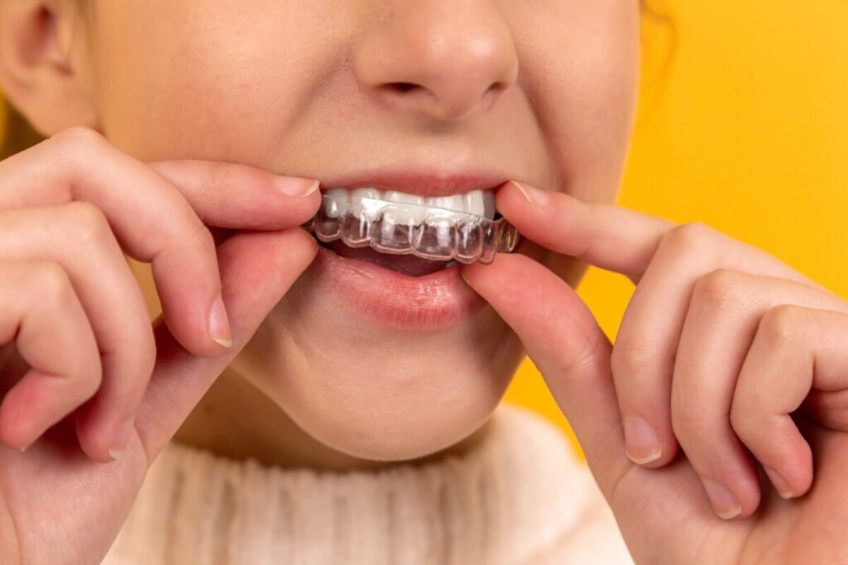 invisalign clear braces near me in calgary