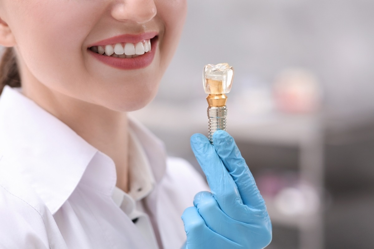 dental implants