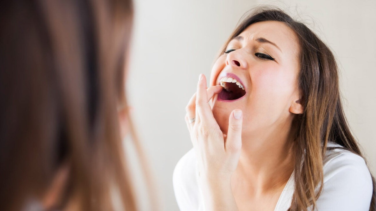 how to remove black spots on teeth home professional treatments
