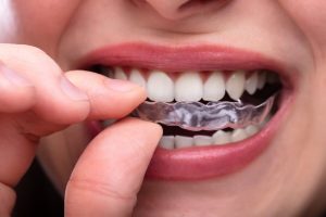 top signs you may be grinding your teeth at night