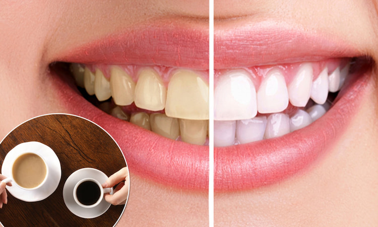 why coffee and tea stain your teeth