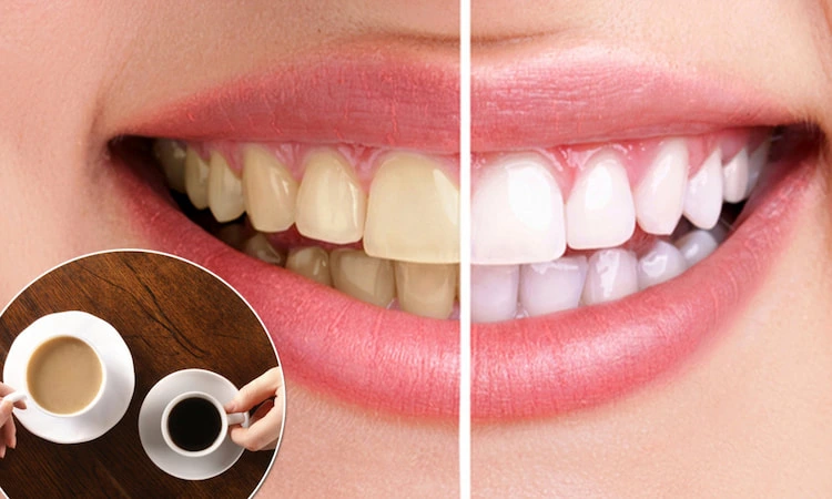 why coffee and tea stain your teeth