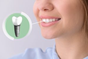 my dental implant broke what should i do