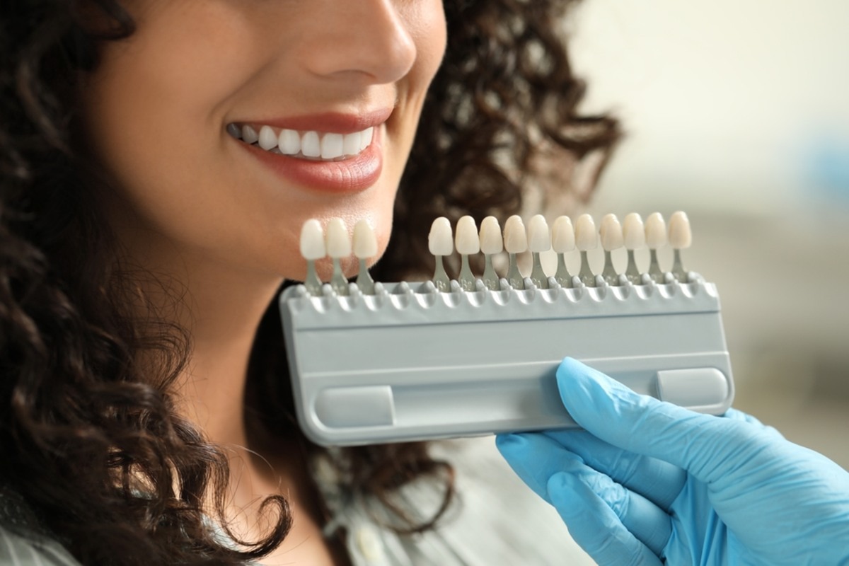 porcelain veneers